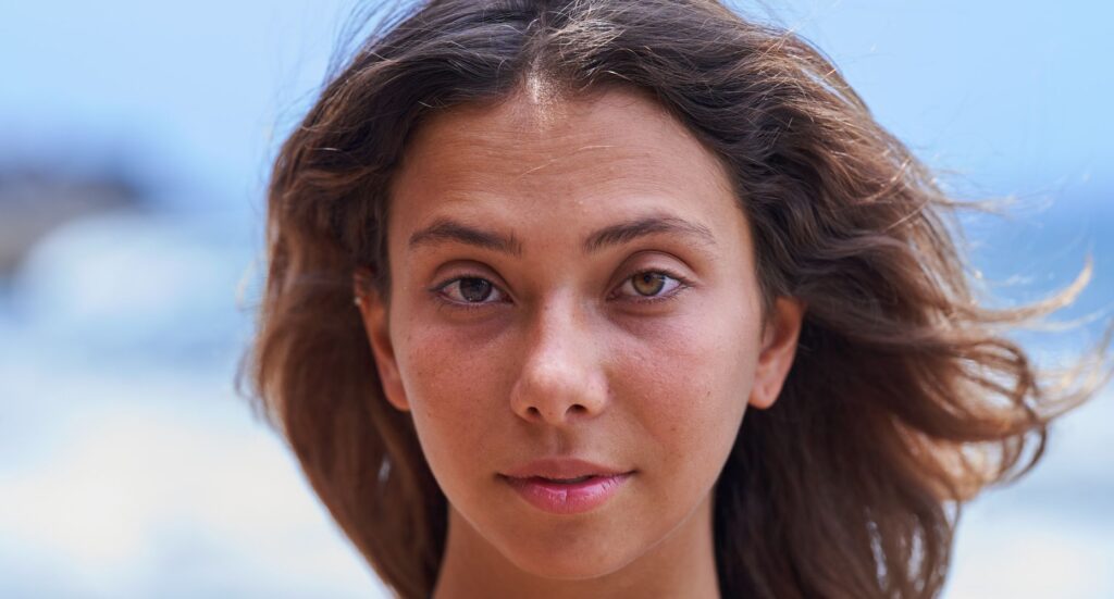 heterochromia